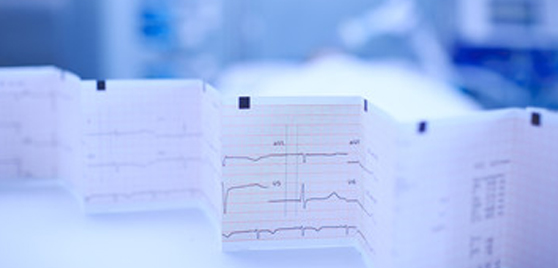 Örnekler Eşliğinde Akut Koroner Sendrom EKG'si Yorumluyoruz